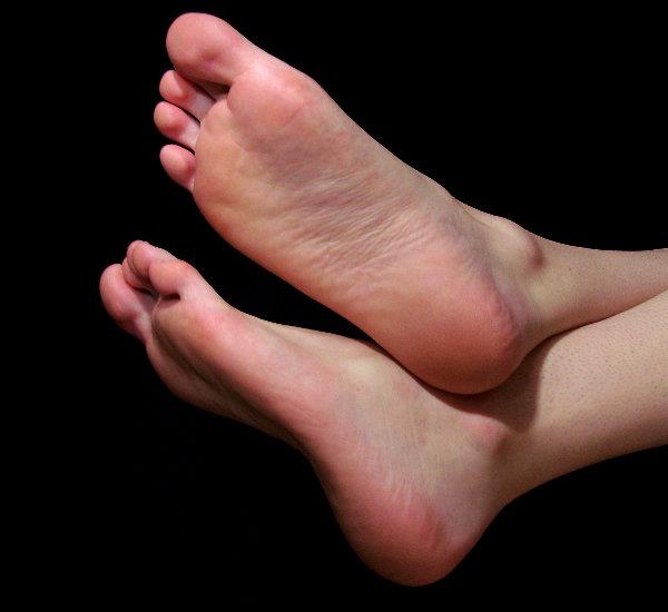 How to cure cracked heels with one of the fastest home remedies