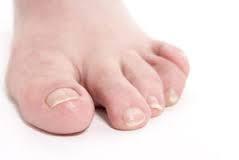 One of the amazing salt foot bath benefits is that it helps you fight those nasty ingrown toenails