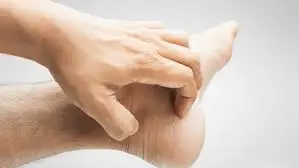 Painful cracked heels might be a cause of skin conditions like eczema, psoriasis or other skin conditions.