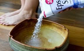 Use Epsom salt as one of the best foot soaks for cracked heels