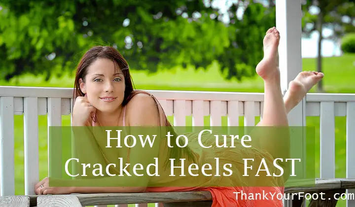 How to Cure Cracked Heels FAST