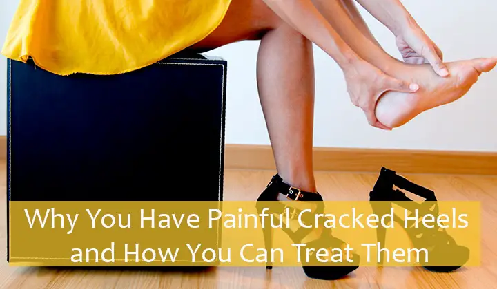 Painful Cracked Heels Treatment