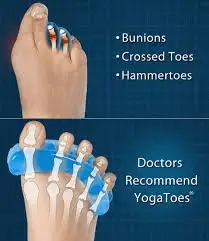 The benefits of toe spacers: They can be used to treat painful foot conditions, naturally.